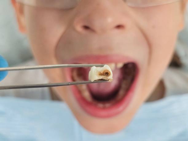 Best Emergency Pediatric Dental Care in Holyoke, MA